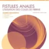 Fistules anales. Utilisation des colles de fibrine, Laurent Abramowitz