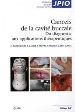 Les cancers de la cavité buccale. Du diagnostic aux applications thérapeutiques, Hervé Tarragano